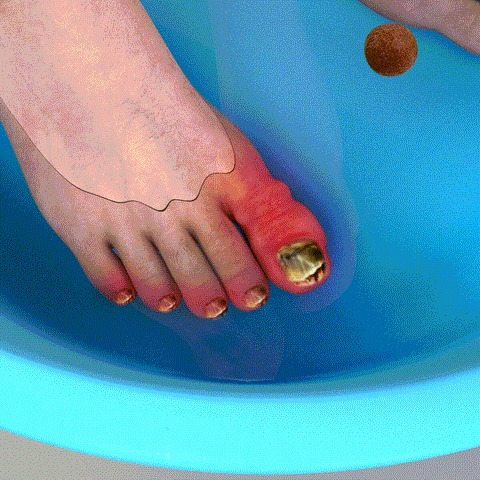 dynabolts pills